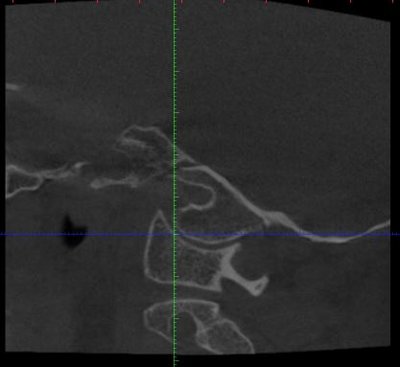 sagittal_r.JPG